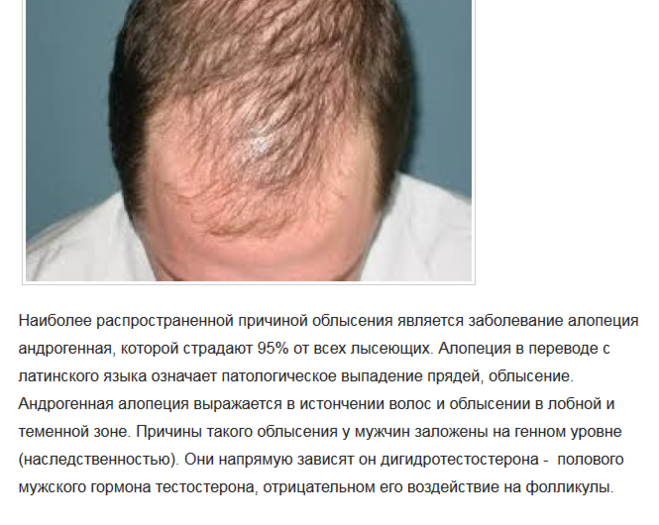 Дигидротестостерон