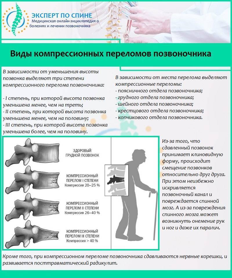 Если потянул мышцу спины и болит поясница что делать. растяжение спины: симптомы и лечение в домашних условиях