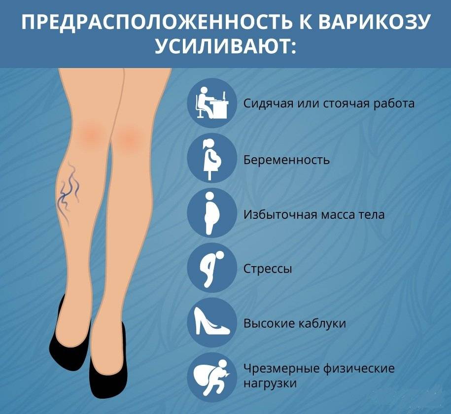 Спорт при варикозе