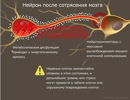 Травма мозга - чмт - последствия Ⓡ современное лечение