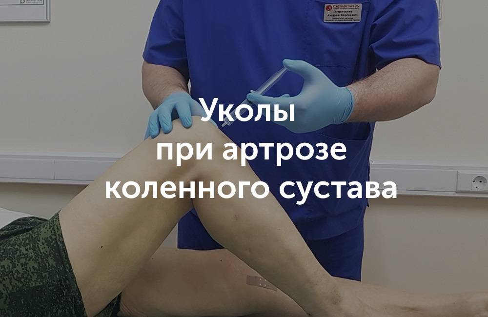 Внутрисуставные инъекции | артромедцентр