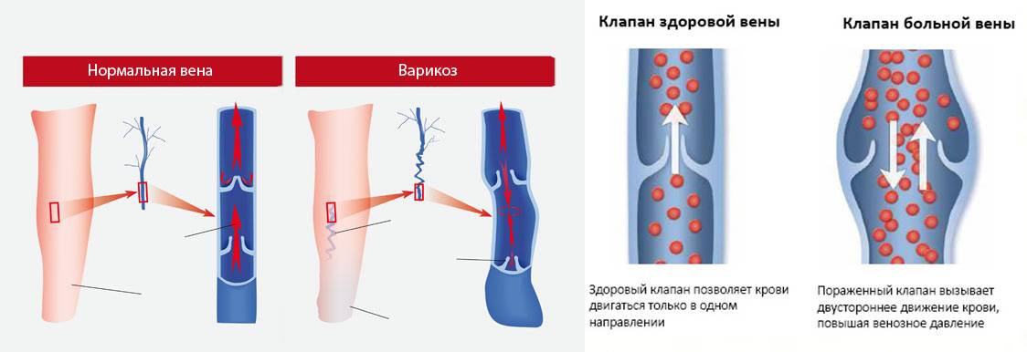 Движение крови по венам