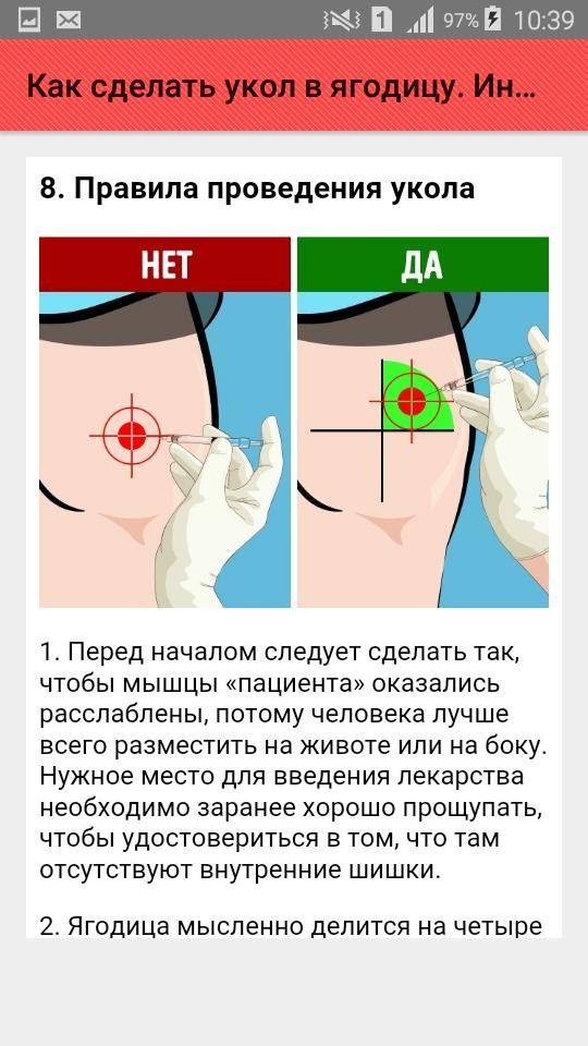 Укол в попу: как делать в ягодицу взрослому правильно для новичков, ставить в домашних условиях, колоть внутримышечно, поставить самому себе, инструкция и схема куда, самостоятельно научиться уколоть