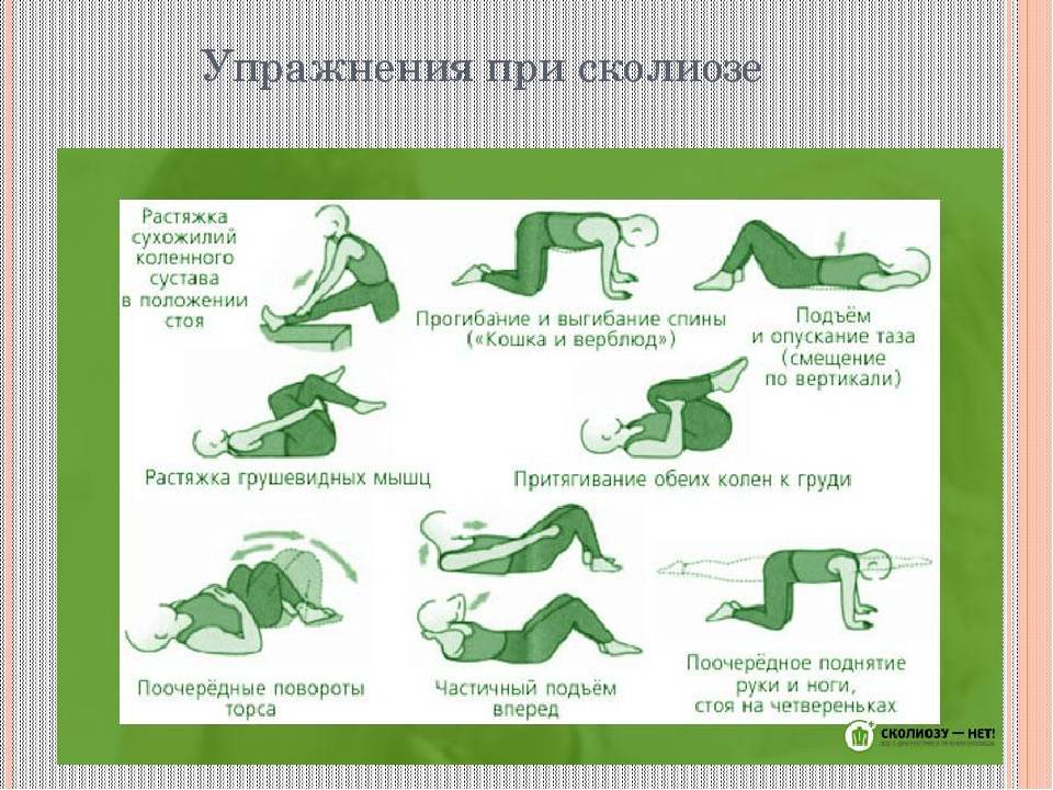 Упражнения для позвоночника при сколиозе. ЛФК упражнения для спины при сколиозе 2. Упражнения ЛФК для спины при сколиозе 1 степени у детей. Упражнения для сколиоза 2 степени для детей. Упражнения при сколиозе позвоночника у подростка 2 степени.