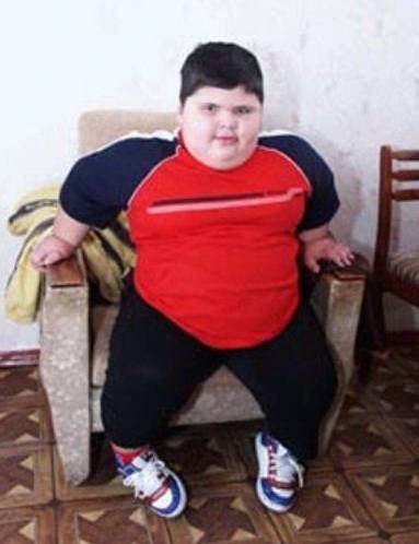 Самые жирные люди в мире, фото самых толстых людей на планете