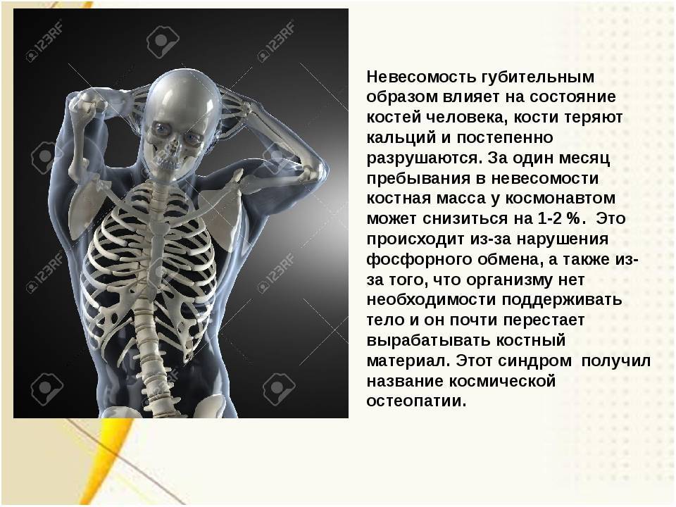 Остеопороз. болезнь возраста, болезнь костей.