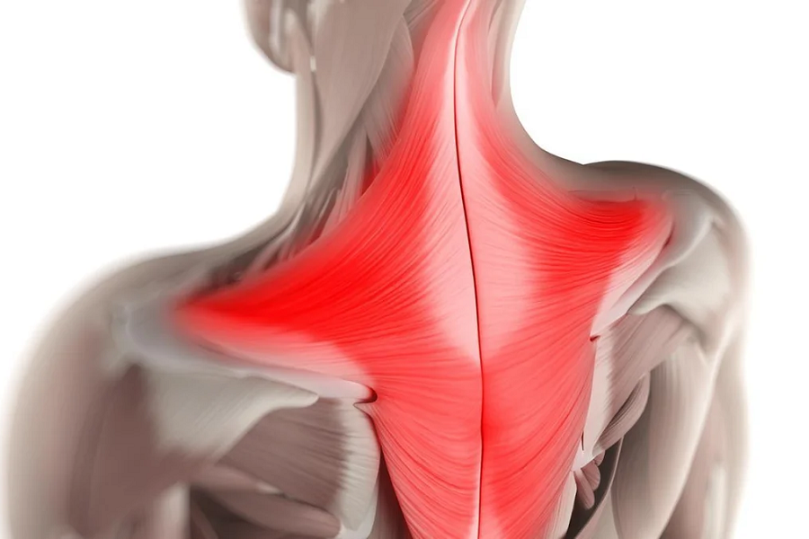 Верхняя трапециевидная. Мышцы шейно-воротниковой зоны анатомия. Трапециевидная мышца шеи анатомия. Трапециевидная мышца спины. Места прикрепления трапециевидной мышцы.