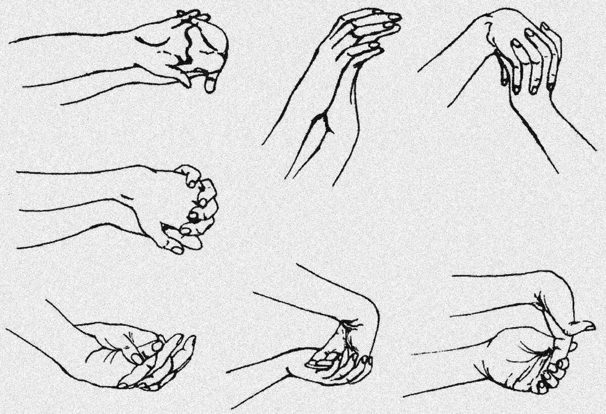 Разработать пальцы после. Разминочные упражнения для кистей и пальцев рук. Гимнастика для пальцев и кистей рук ЛФК. Лечебная гимнастика после перелома лучевой кости. Гимнастика для кисти после перелома.