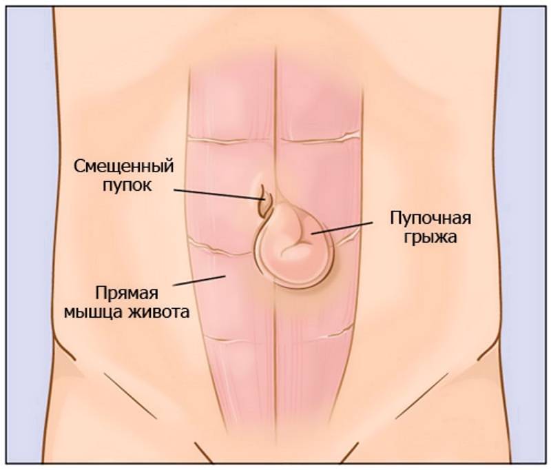 А вы знаете, что находится за пупком: как он выглядит с другой стороны + рисунок его строения изнутри