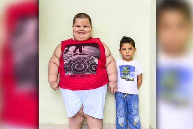 10 самых невероятных историй похудения: фото до и после - infa-star
