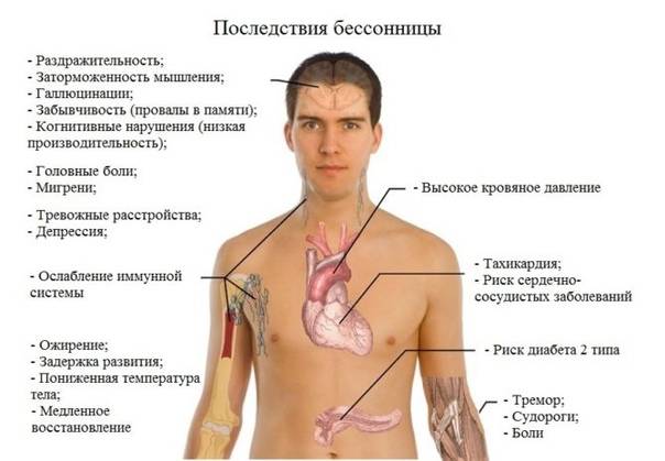 Каковы последствия недосыпания? | buzunov.ru